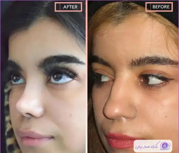عکس محسن یگانه قبل و بعد از عمل بینی