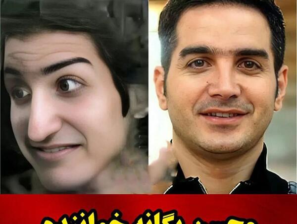 عکس محسن یگانه قبل و بعد از عمل بینی