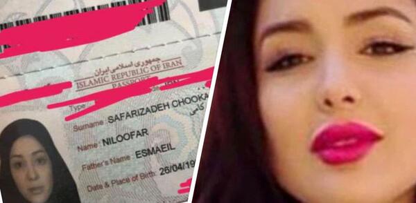 عکسهای قبل از عمل نیلی افشار