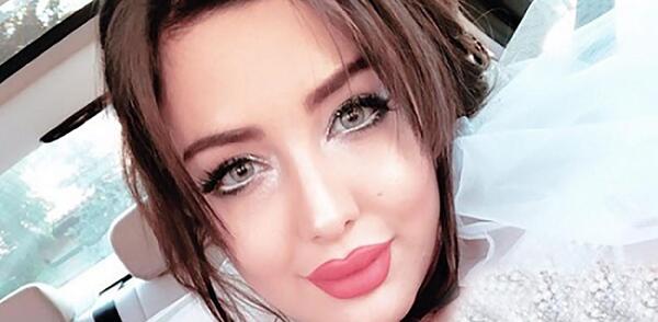 عکسهای قبل از عمل نیلی افشار
