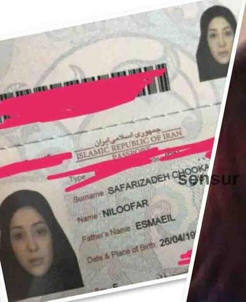 عکسهای قبل از عمل نیلی افشار