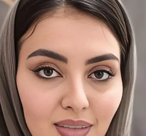 عکسهای قبل و بعد از تزریق چربی صورت