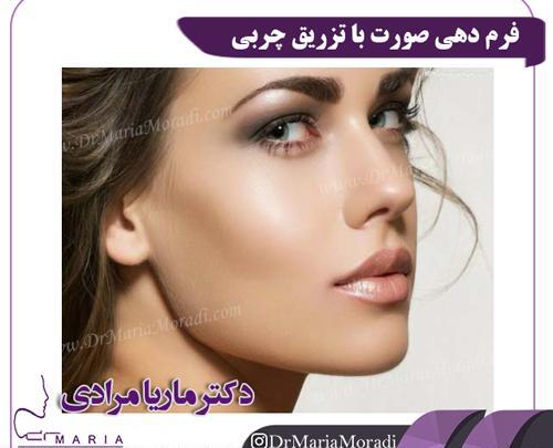 عکسهای قبل و بعد از تزریق چربی صورت