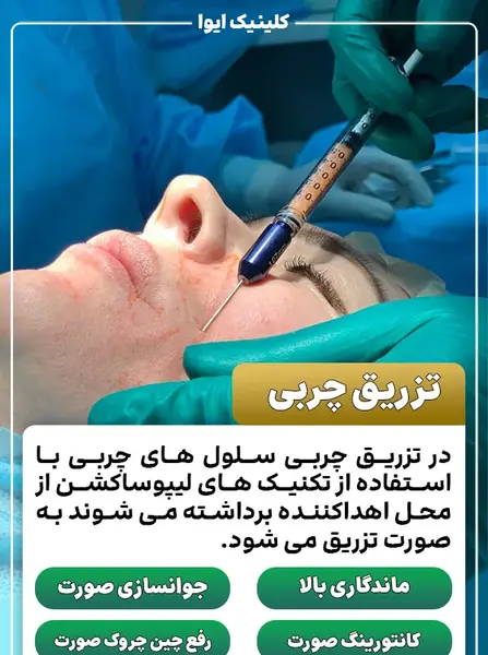 عکسهای قبل و بعد تزریق چربی صورت