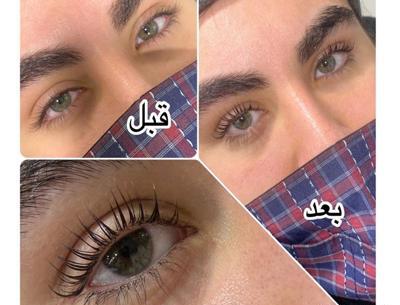 عکس قبل و بعد لیفت و لمینت ابرو
