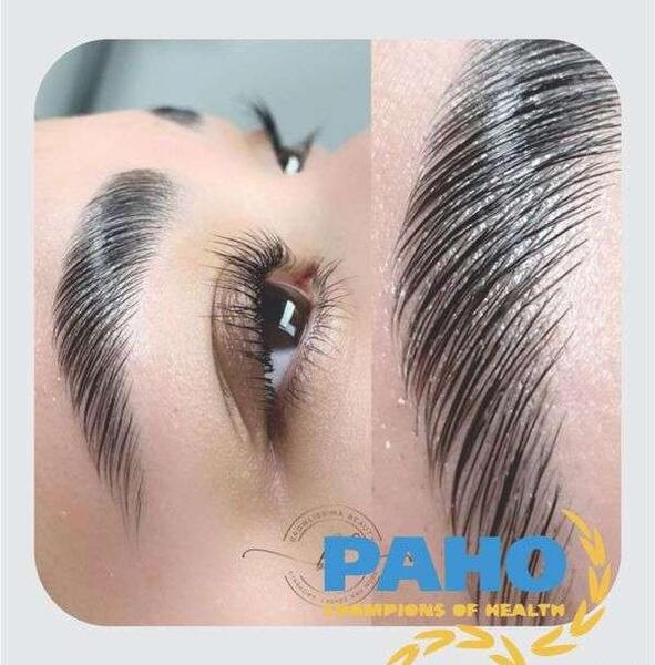 عکس قبل و بعد لیفت و لمینت ابرو