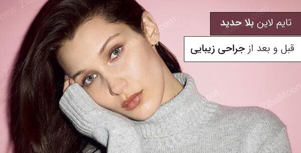 عکس نسرین جوادزاده قبل از عمل زیبایی