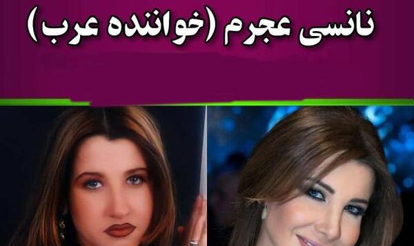 عکس قبل و بعد نانسی