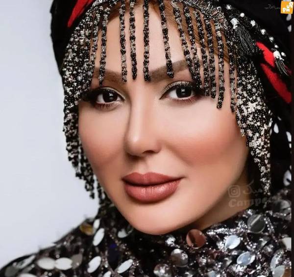 عکس قبل و بعد نیوشا ضیغمی