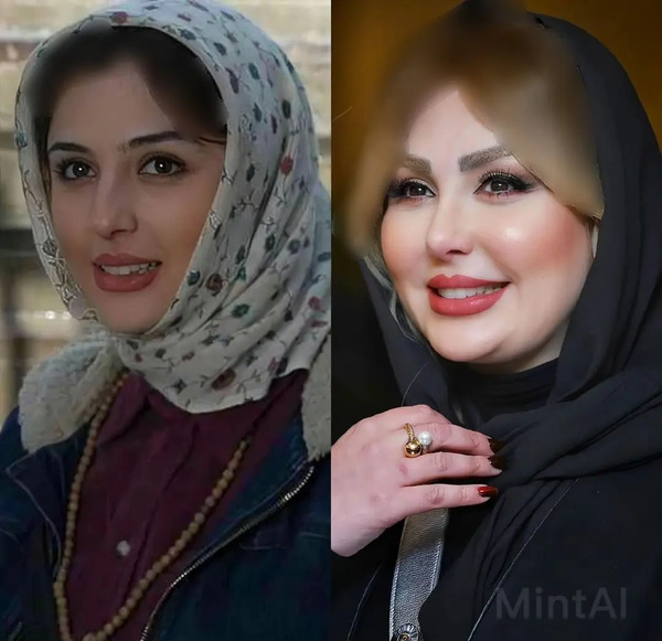 عکس قبل و بعد نیوشا ضیغمی