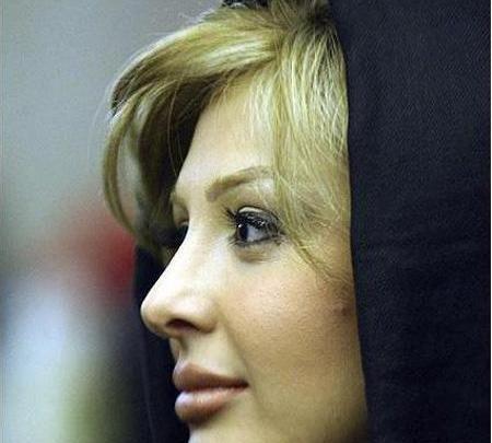 عکس قبل و بعد نیوشا ضیغمی