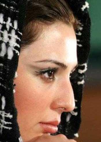 عکس قبل و بعد نیوشا ضیغمی