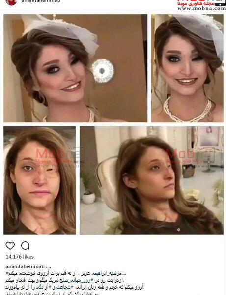 عکس مرضیه ابراهیمی قبل از اسید پاشی