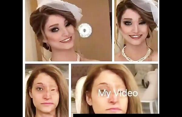 عکس مرضیه ابراهیمی قبل از اسید پاشی