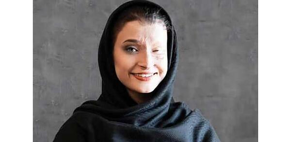 عکس مرضیه ابراهیمی قبل از اسید پاشی