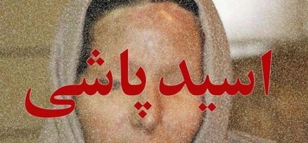 عکس مرضیه ابراهیمی قبل از اسید پاشی