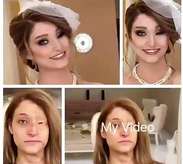 عکس مرضیه ابراهیمی قبل از اسید پاشی