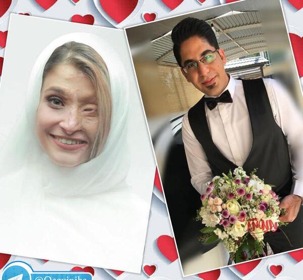 عکس مرضیه ابراهیمی قبل از اسید پاشی