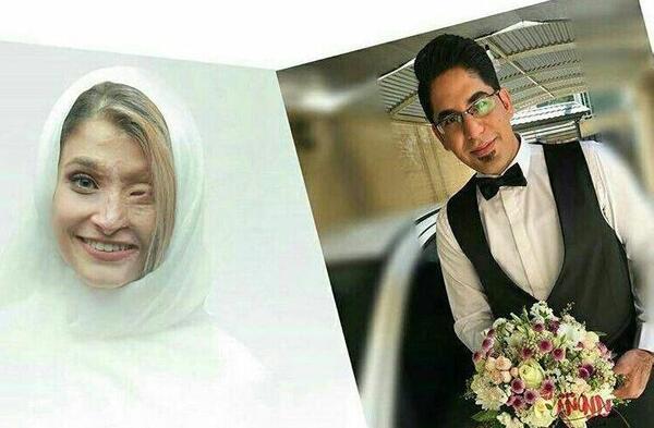 عکس مرضیه ابراهیمی قبل از اسید پاشی