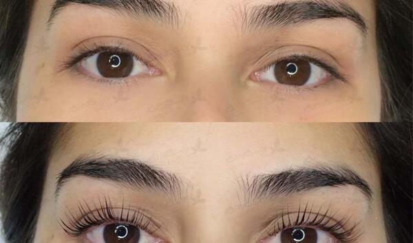 عکس قبل و بعد لیفت مژه و ابرو