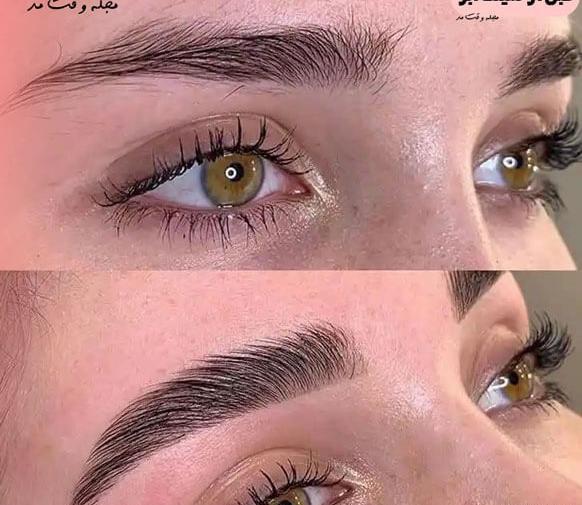 عکس قبل و بعد لیفت مژه و ابرو