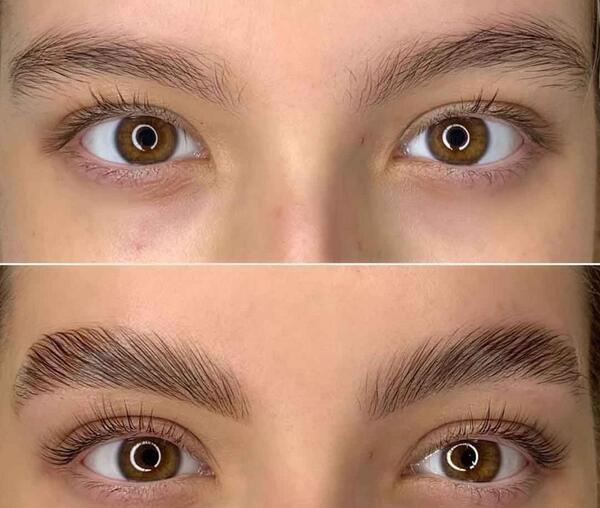 عکس قبل و بعد لیفت مژه و ابرو