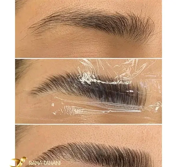 عکس قبل و بعد لیفت مژه و ابرو