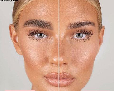 عکس قبل و بعد لیفت مژه و ابرو