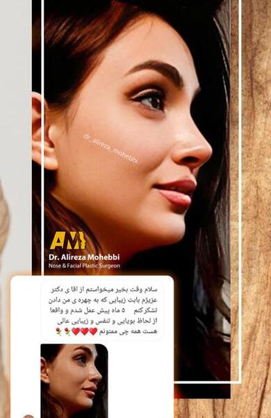 عکس لیلا در سریال سیب ممنوعه قبل از عمل