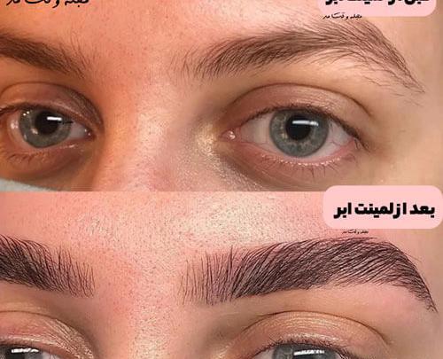 عکس قبل و بعد لیفت و لمینت مژه