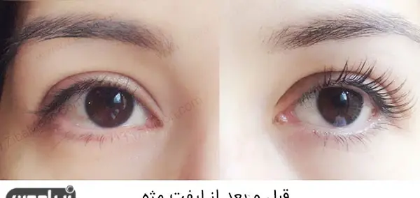 عکس قبل و بعد لیفت و لمینت مژه