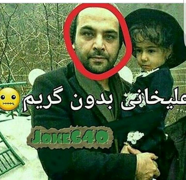 عکسهای احسان علیخانی قبل از کاشت مو