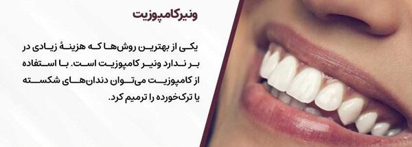 عکس قبل و بعد کامپوزیت نی نی سایت
