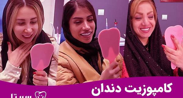 عکس قبل و بعد کامپوزیت نی نی سایت