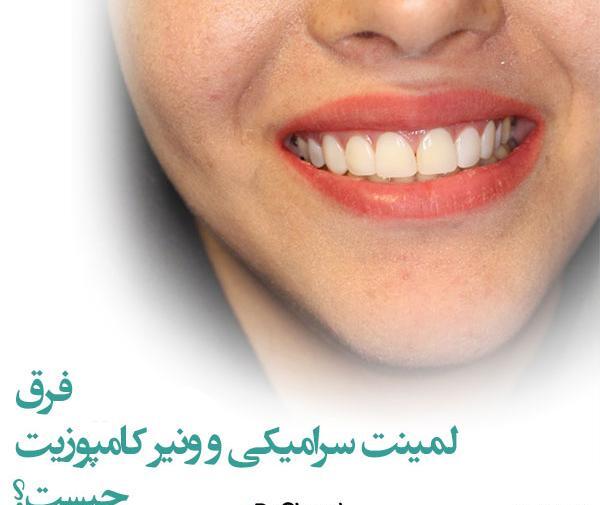 عکس قبل و بعد کامپوزیت نی نی سایت