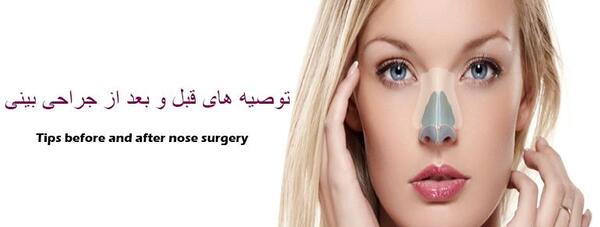 عکس گرفتن قبل عمل بینی