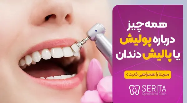 عکس قبل و بعد پالیش کامپوزیت