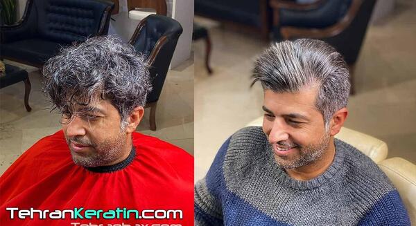 عکس قبل و بعد کراتینه مو مردانه