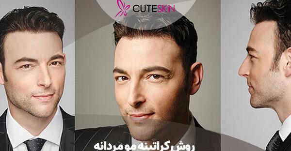 عکس قبل و بعد کراتینه مو مردانه