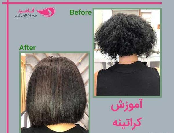 عکس قبل و بعد کراتینه مو مردانه