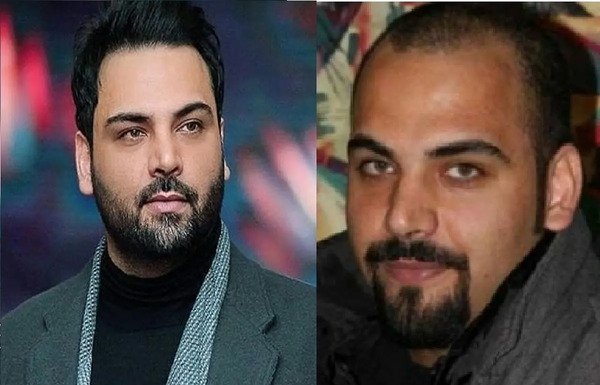 عکس های احسان علیخانی قبل کاشت مو