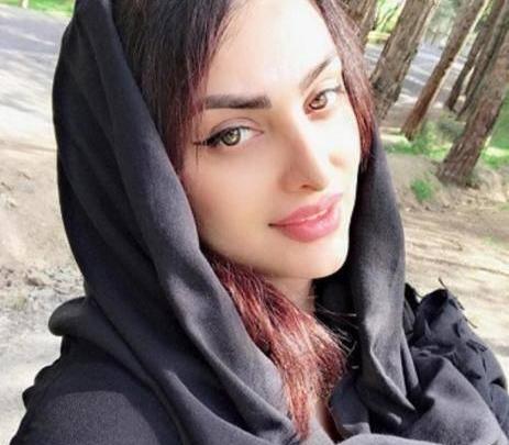 عکس قبل عمل سایه افضلی