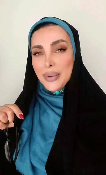 عکس قبل عمل سایه افضلی