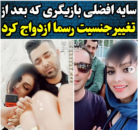 عکس قبل عمل سایه افضلی