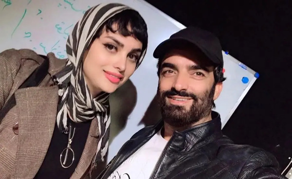 عکس قبل عمل سایه افضلی