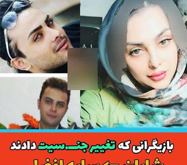 عکس قبل عمل سایه افضلی