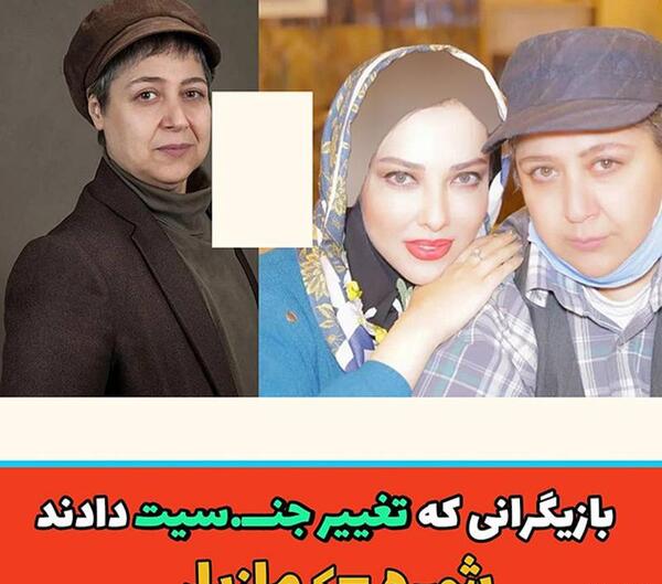 عکس قبل عمل سایه افضلی
