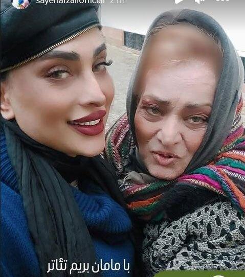 عکس قبل عمل سایه افضلی