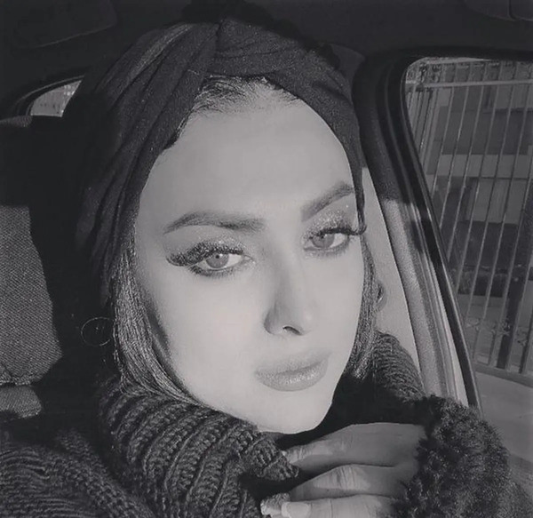 عکس قبل عمل سایه افضلی