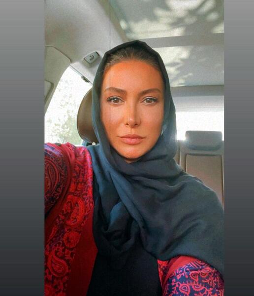 عکس قبل عمل بینی فریبا نادری
